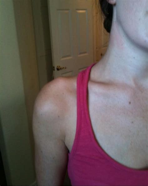 How to get your chest bones to stick out prothinspo pro ana. Does anyone else have bones on shoulders that stick out ...