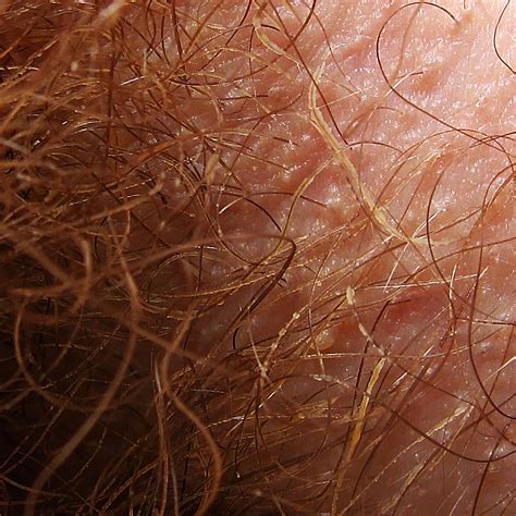 Pubic hair acts like a defensive barrier between you and the things you come into contact with, rieder says. Trichobacteriosis axillaris - Wikipedia