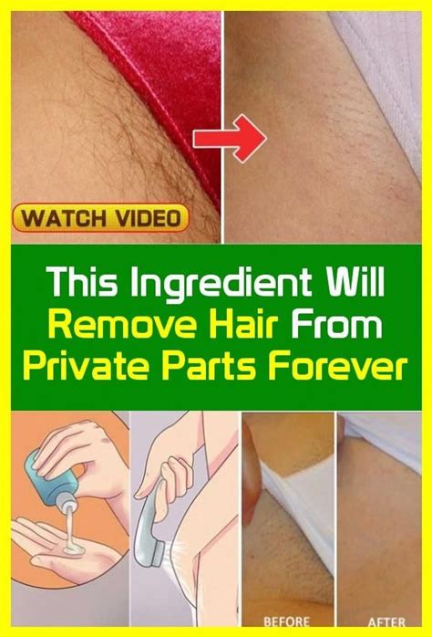 This treatment treats individual hair follicles, one at a time, unlike lasers which usually treat multiple hair follicles within a designated area. This ingredient will remove hair forever from private ...