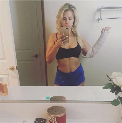 Macdonald, a former bellator welterweight champion, lost a controversial split decision to ufc veteran gleison tibau on. Paige VanZant Shows Off Her Broken Arm