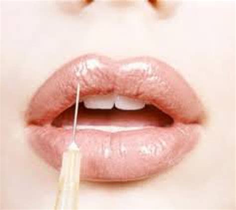 This process is divided into several steps such as basic research to clinical trials to ensure safety. Thinking Of Getting Lip Fillers? Here's Everything You ...