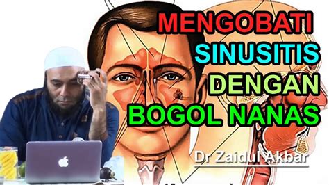 Resep sehat dokter zaidul akbar. Resep Jsr Hidung Tersumbat - Resep JSR ZAIDUL AKBAR