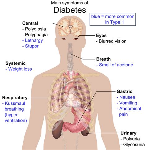 Maybe you would like to learn more about one of these? File:Main symptoms of diabetes.png