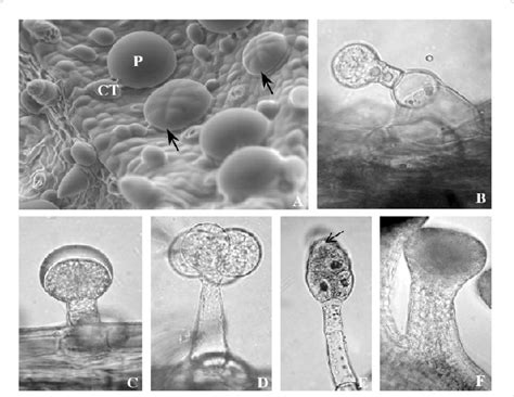 Light micrographs of capitate and peltate glandular trichomes. Diversity of secretory trichomes among the Lamiaceae (A, B ...