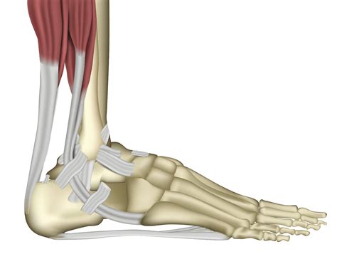 Die achillessehne ist die endsehne des aus drei muskeln bestehenden musculus triceps surae am unterschenkel. Achillessehne - Wuppertaler Fuß - Initiative