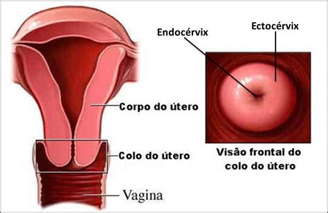 Decimos que una mujer padece cancer de utero cuando las células que lo forman crecen de una forma desordenada y anárquica, dando lugar a la dependiendo del grado de afectación, serealizará además tratamiento con radioterapia. Carcinoma de colo uterino/Carcinoma of the cervix