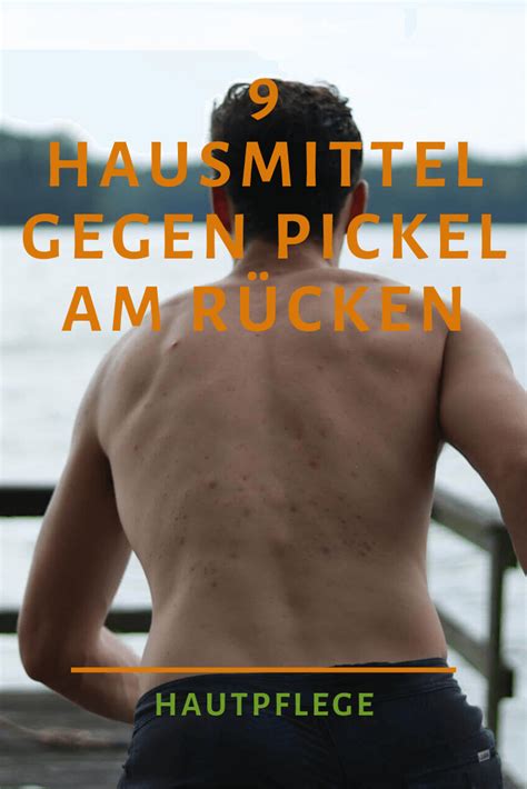 Hausmittel gegen verkapselte pickel unter der haut entfernen und behandeln an hals po rücken im. Hausmittel gegen Pickel am Rücken: → einfach & zuverlässig ...