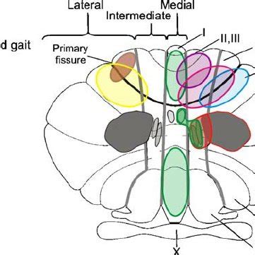 Schematic sketch of main findings in patients with focal cerebellar... | Download Scientific Diagram