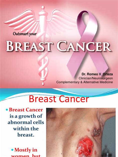 What are the symptoms of breast if it is diagnosed when the cancerous cells are still within the duct or lobule, it is known as ductal. Breast Cancer | Breast Cancer | Menopause