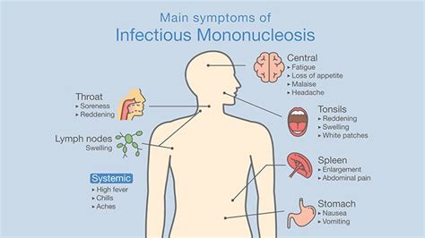 Most people are infected by the virus as children, when the disease produces few or no symptoms. Adult in strep symptom - Pics and galleries