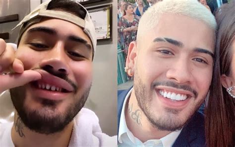 Ouvir cronograma de atualização da playlist: Kevinho mostra, mais uma vez, seus dentes desgastados na ...