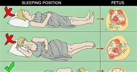This position allows him to keep most of his weight off your belly. Can You Sleep On Your Stomach While Pregnant?