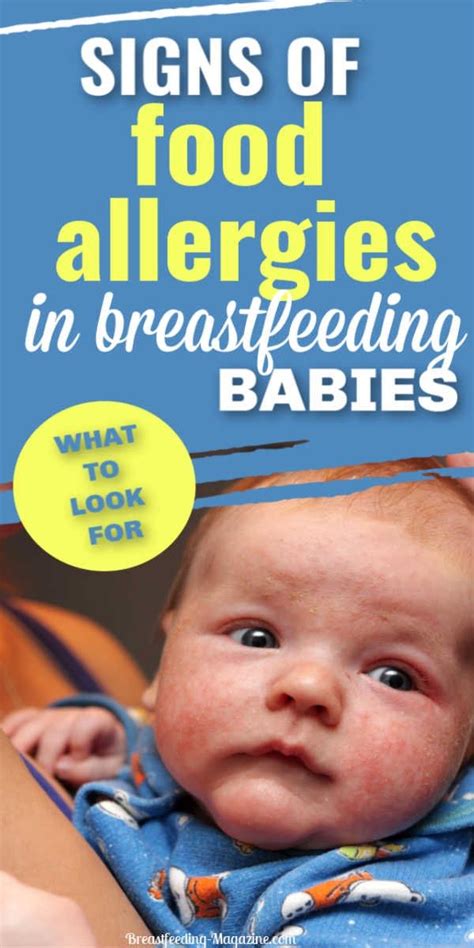 Food allergy in breastfed infants infants who are exclusively breastfed can show signs and symptoms of food allergies. Food Allergies in Babies Who Breastfeed - Common Signs and ...