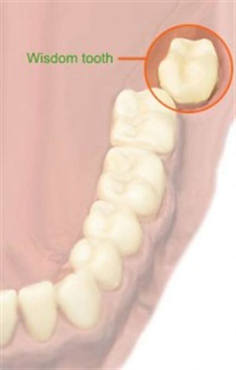 So a word of wisdom is a small snippet of the knowledge of god applied. Guide to Wisdom Teeth Removal | Intelligent Dental