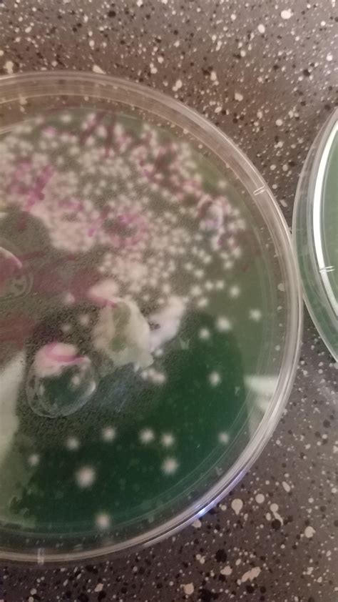 Spore syringe versus spore prints in agar. General Agar to agar transfer and I get a bunch of spots ...