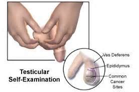 A general feeling of malaise, including unexplained fatigue, fever, sweating, coughing, shortness of breath or mild chest pains. Causes of Testicular Cancer and What Does It Feel Like
