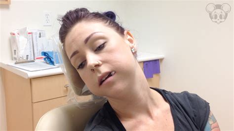 Maybe you would like to learn more about one of these? Four Wisdom Teeth Removed...the before & after!! - YouTube