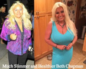 For those in the rumor mill, such statements tend to … Beth Chapman Boobs Reduction Plastic Surgery Rumors ...