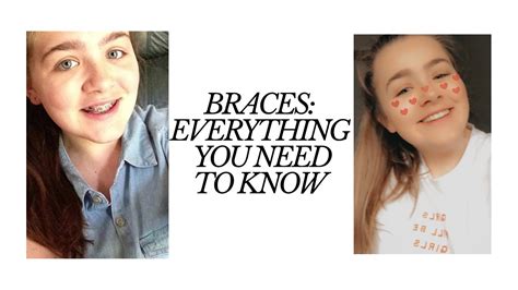 Answer for when is anytime after the age of 12 one can get the teeth alignment assessed and during growth it's the best to get the braces. Everything You Need To Know About Braces! - YouTube