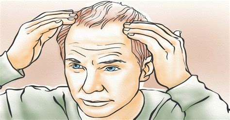 Almost all men and women will notice hair loss or hair thinning as they age. The Biggest Myths About Hereditary Hair Loss | | Surgery Group