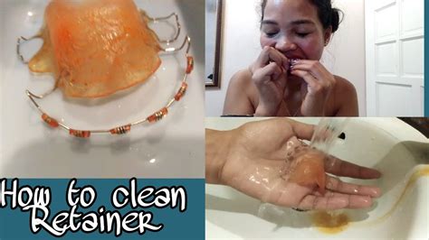 Clean your retainers every day by brushing them with toothpaste, a mild soap, or denture cleaner. How to clean Retainer | Update |Philippines - YouTube