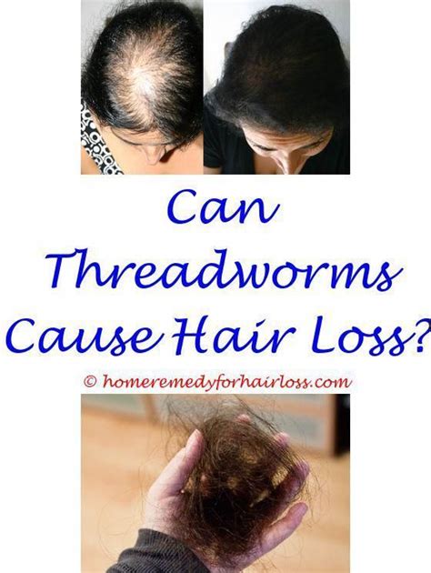 This training and depth of knowledge are vital. is hair greying and hair loss related - dermatologists ...