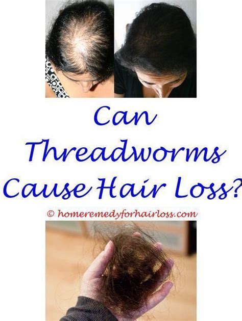 This training and depth of knowledge are vital. is hair greying and hair loss related - dermatologists ...