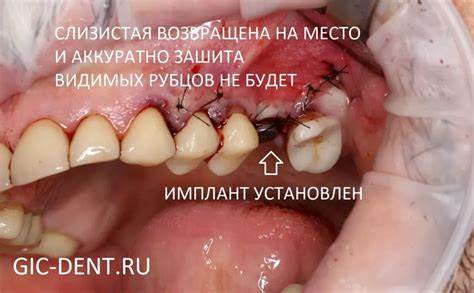 Как держаться во время диеты