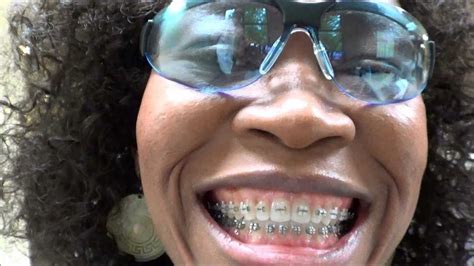 Whether it's taking time off from running due to injury, taking a break to recover after a marathon, or a hectic life just getting in the way, we as runners are not great at missing training. {#95}: GETTING MY BRACES OFF PREPARATION & RETAINERS ...