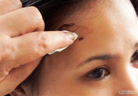 After all, we invented ways to remove hair from your balls. Useful Ideas On How To Remove Hair Dye From Skin - AllDayChic