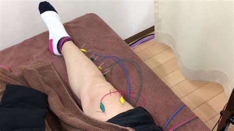 変形性膝関節症に効果がある鍼治療!福岡県春日市にある ...