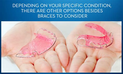 Check spelling or type a new query. How to Straighten Teeth without Braces - Oral-B