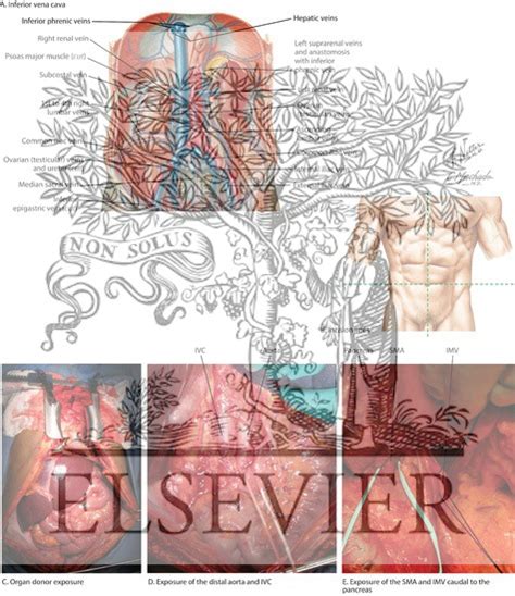 The abdomen contains organs involved in the gastrointestinal tract, including the oesophagus the abdominal vasculature consists of various arterial branches that all come from the aorta, and two. Abdominal Anatomy and Organ Procurement Exposures