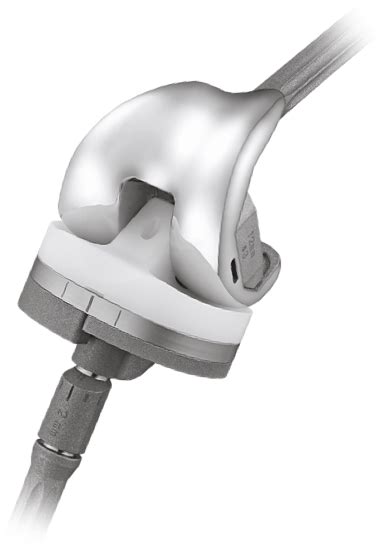 U2 PSA Knee | Hip and Knee Implants | United Orthopedic ...