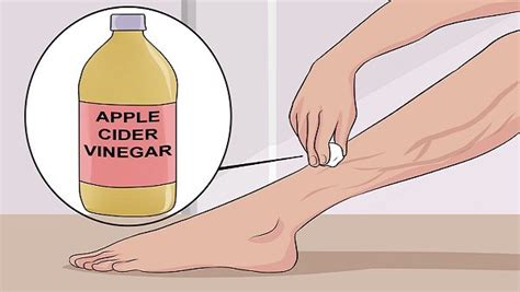 Patients often require diagnostic ultrasound examinations of the leg. 10 Ways to Get Rid of Spider Veins on Your Legs Naturally