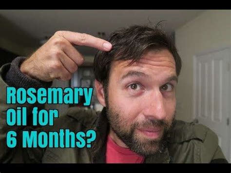 Watch for skills, and the desire to use them, to grow by leaps and bounds now. Rosemary Oil for My Hair Loss: Photos Before and After, 6 ...