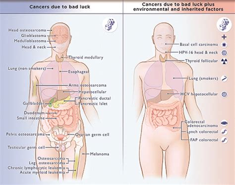 While all these are valid and important risk increasing factors, random. Most Cancers Due to Bad Luck, Not Heredity or Lifestyle