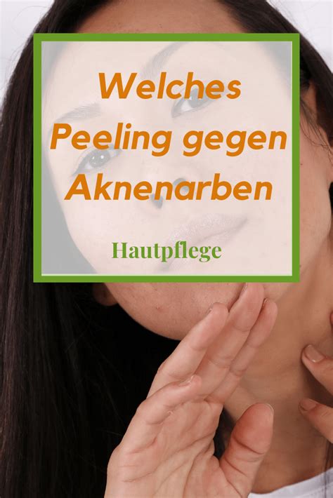 We did not find results for: Peeling gegen Aknenarben | Aknenarben, Akne, Akne narben ...