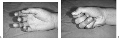 What is functional muscle testing. Flexor Tendon - TeachMe Orthopedics