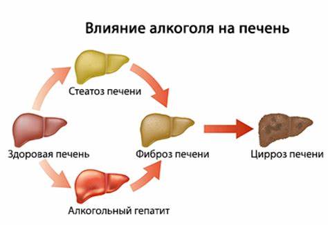 Гепатит симптомы диета Алкогольный гепатит: симптомы, особенности лечения и диета Алкогольный гепатит: симптомы, особенности лечения и диета Гепатит симптомы диета