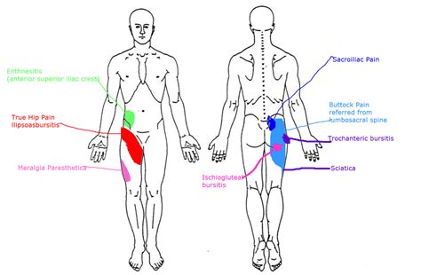 A ship is like a floating city comprising of different parts. Hip Pain - New Hope Family Chiropractic