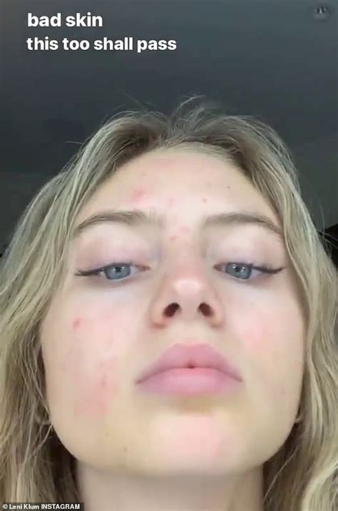 German model heidi klum, 36, gave birth to her fourth child, a daughter named lou sulola samuel, on friday. Heidi Klum's daughter Leni, 16, gets real about her acne ...