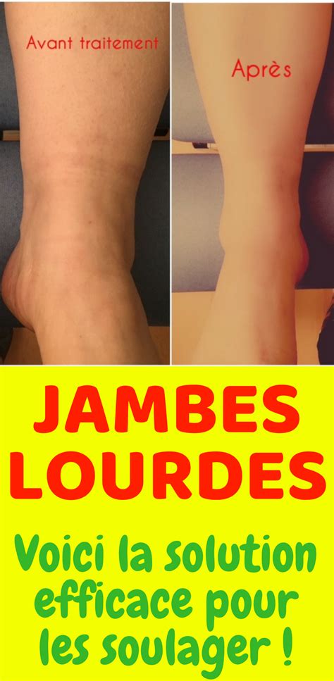 Remède Jambes Lourdes | jambes lourdes | jambes lourdes remede | jambes ...