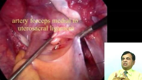 Find out more about the symptoms and how it's diagnosed and treated. 3rd Degree uterine prolapsed - YouTube