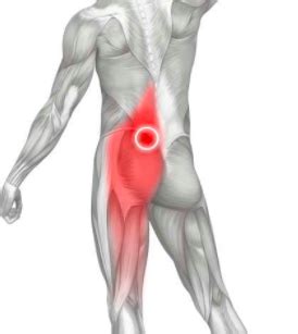 The glute medius' anterior muscle fibers internally rotate the thigh and the posterior fiber play a role the glute exercises below vary greatly—and that's not an accident. Are weak glutes causing your lower back pain? - Specht ...