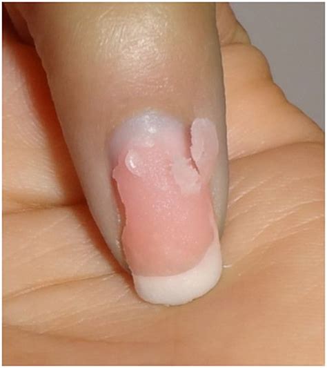 However, acetone can cause skin irritation and drying. How to Remove Acrylic Nails At Home (With & Without ...