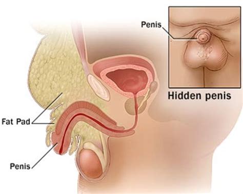 Age can imbue older men with traits that women can't help but find attractive. Home - Anandan's Andrology Clinic