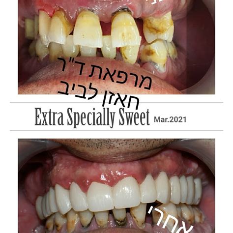 שירותי משלוחים לתשובי דיר אל אסד. Labib khazen dental clinic - Home | Facebook