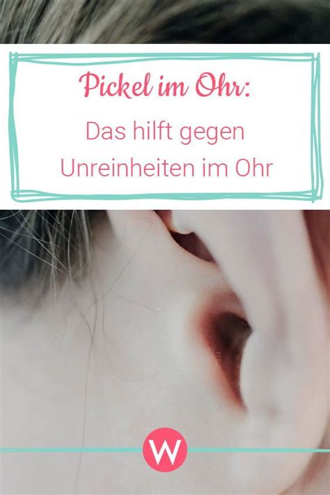 Es bezieht sich auf alles von whiteheads und mitessern bis zu zysten und knötchen. Pickel im Ohr - was kann ich dagegen tun? | Wunderweib ...