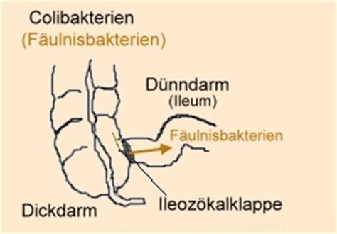 Bei verstärkter gasbildung nach operationen. Nahrungsergänzung Bitterkräuter Bittere Heilpflanzen für ...